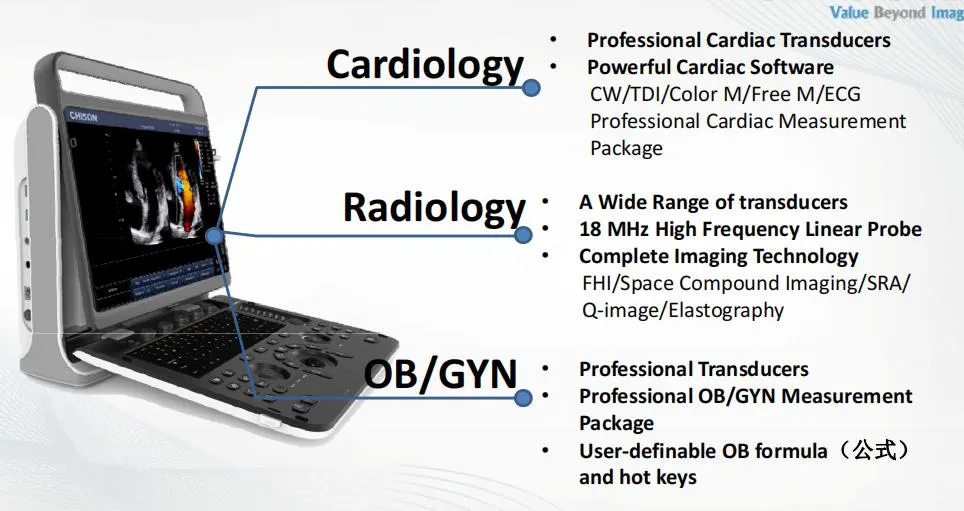 Color Doppler System Display 1