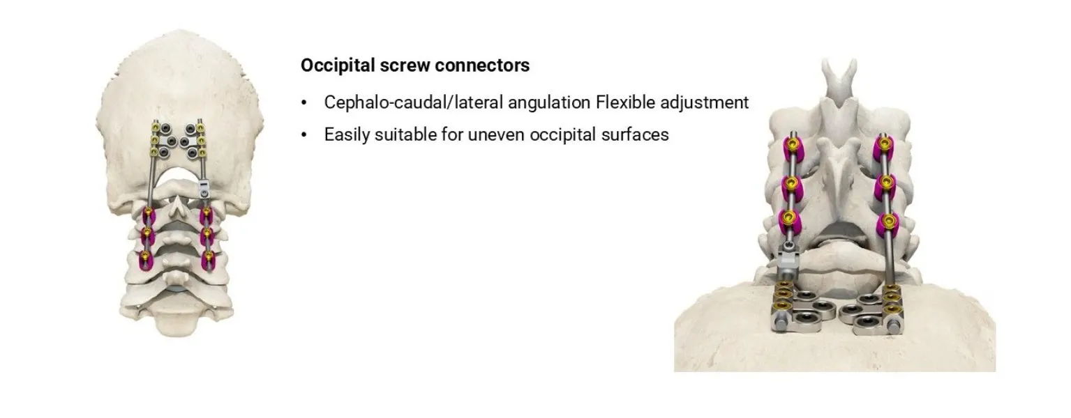 Spinal System Component 4