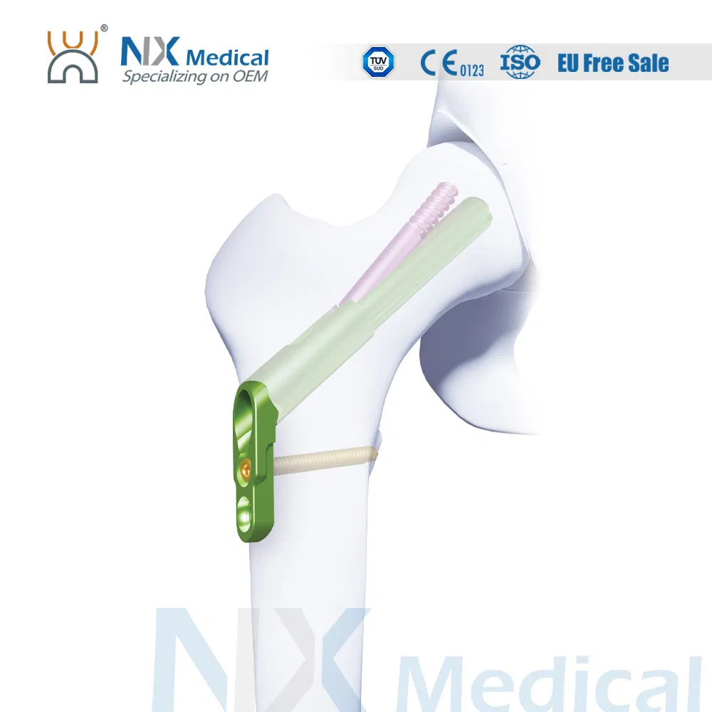 Nx Medical OEM Locking Plate Femoral Neck System 130° for Trauma Repair