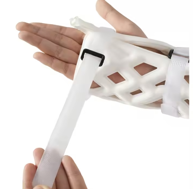Portable Hand External Fixation System for Trauma and Orthopedic Surgery Orthopedic External Fixation Splint
