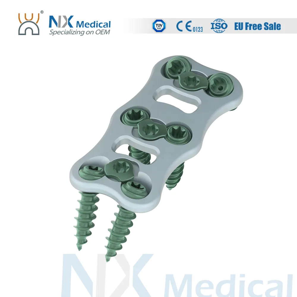 Nx Medical Anterior Cervical Plate System Spine Internal Fixation Titanium China Factory