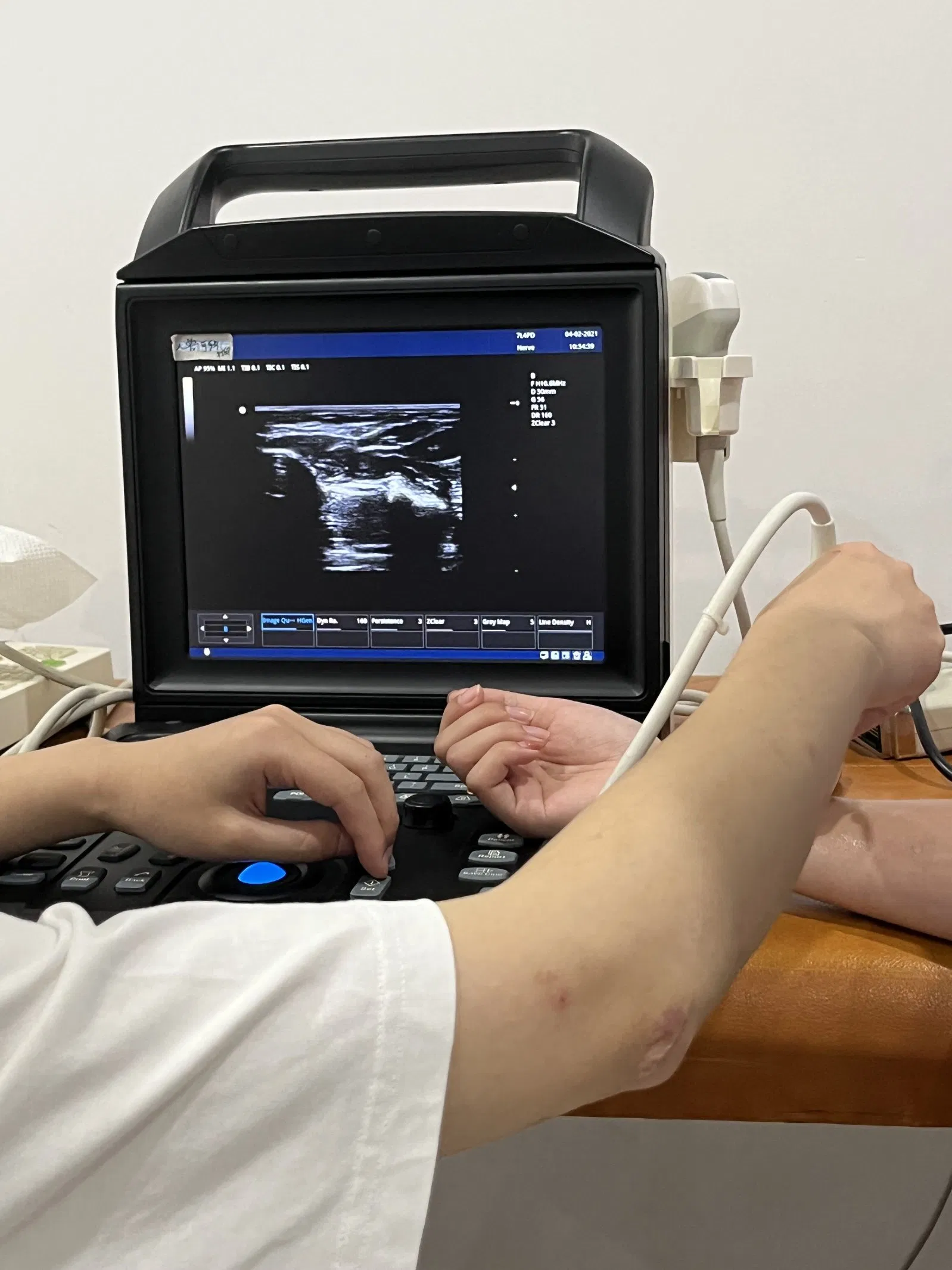 Ltub73 High Efficiency Portable 12 Inch Color Doppler Ultrasound System