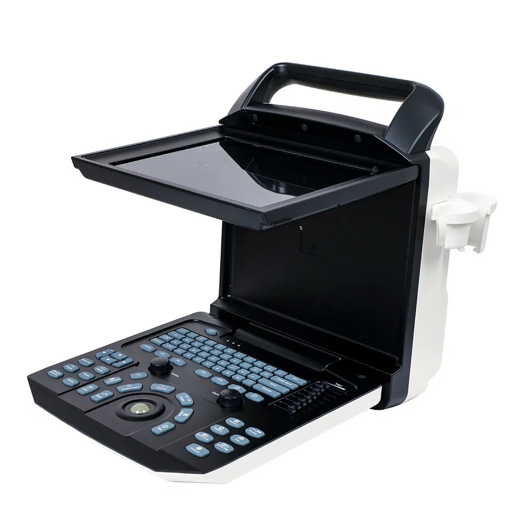 Portable Medical Ultrasonic Ecografo Color Doppler Laptop Cardiac Ultrasound System