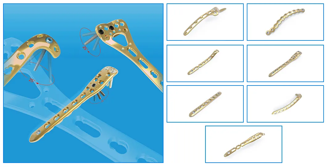 Trauma Fixation Plate