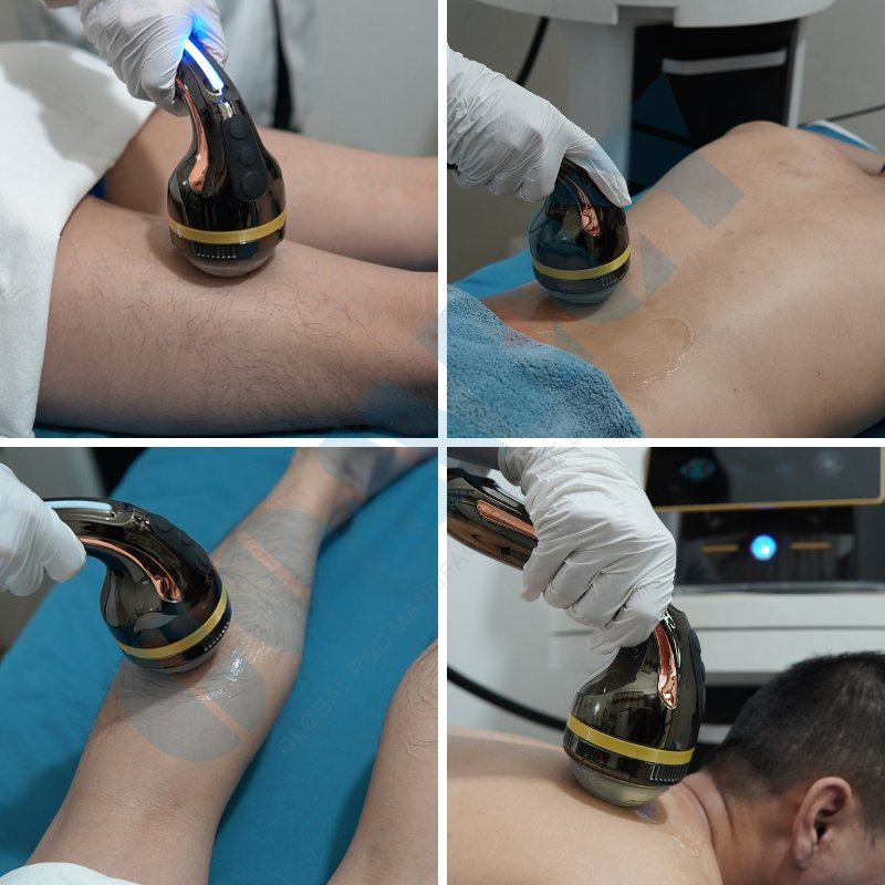 Focused Shockwave Therapy System for Bone Repair and Muscle Injury Physical Rehabilitation