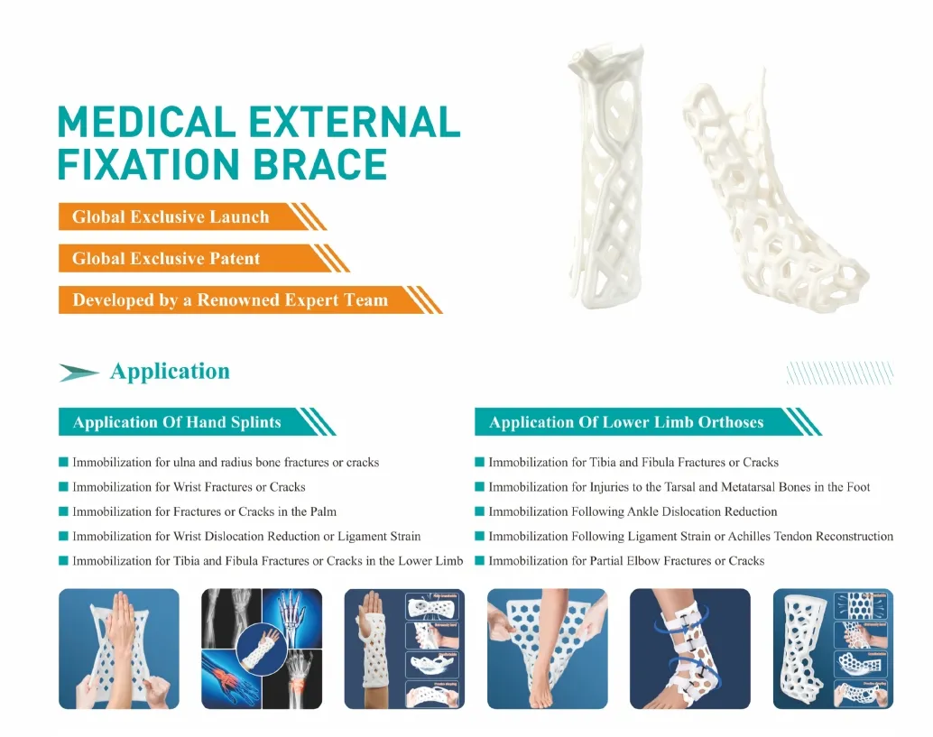 Orthopedic External Fixation Splint View 2