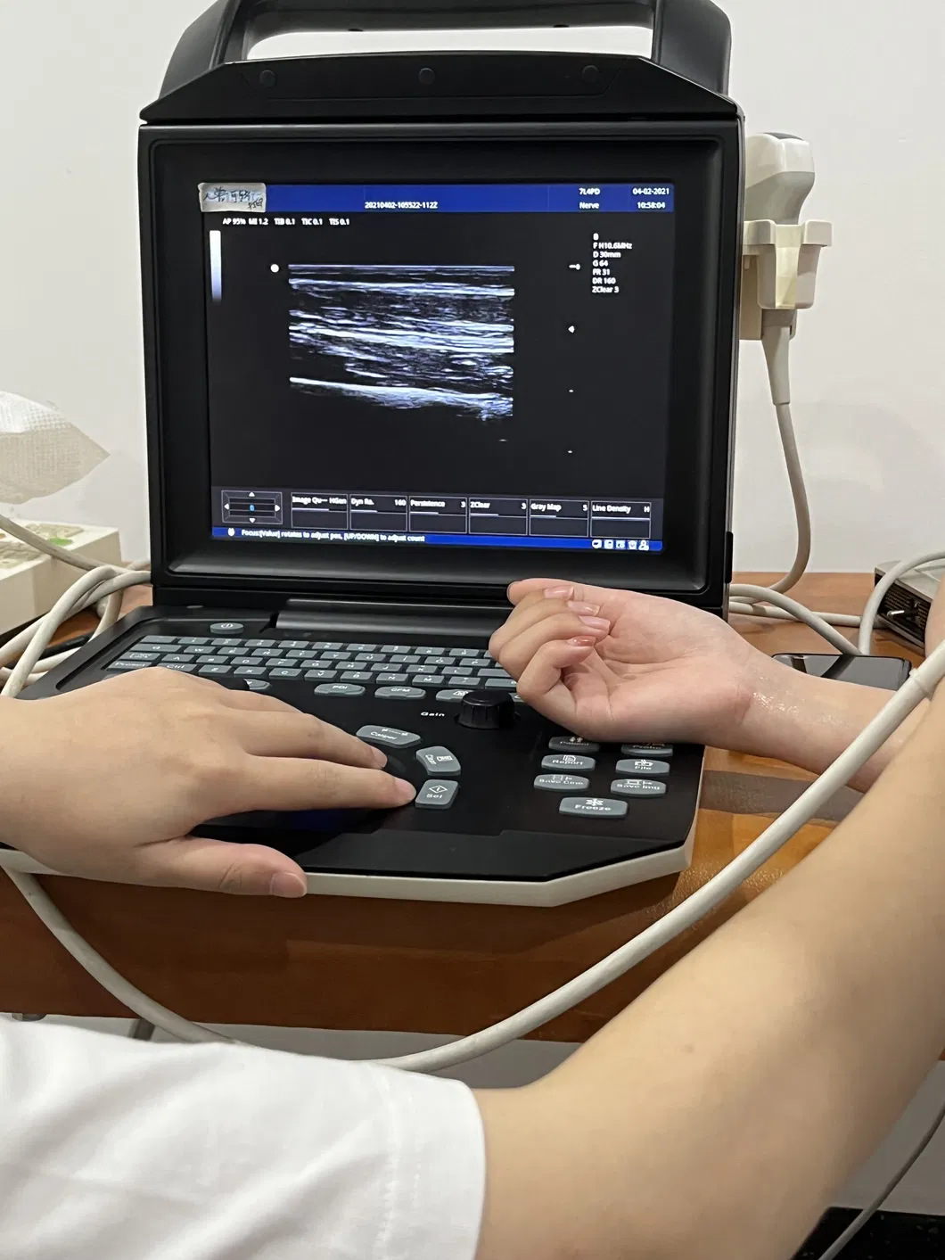 Ultrasound System Detailed 3