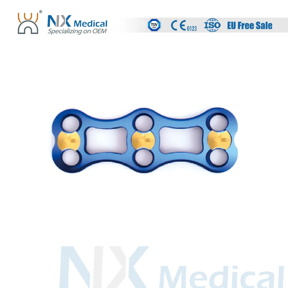 Nx Medical Anterior Cervical Plate System Spine Internal Fixation Titanium OEM ODM