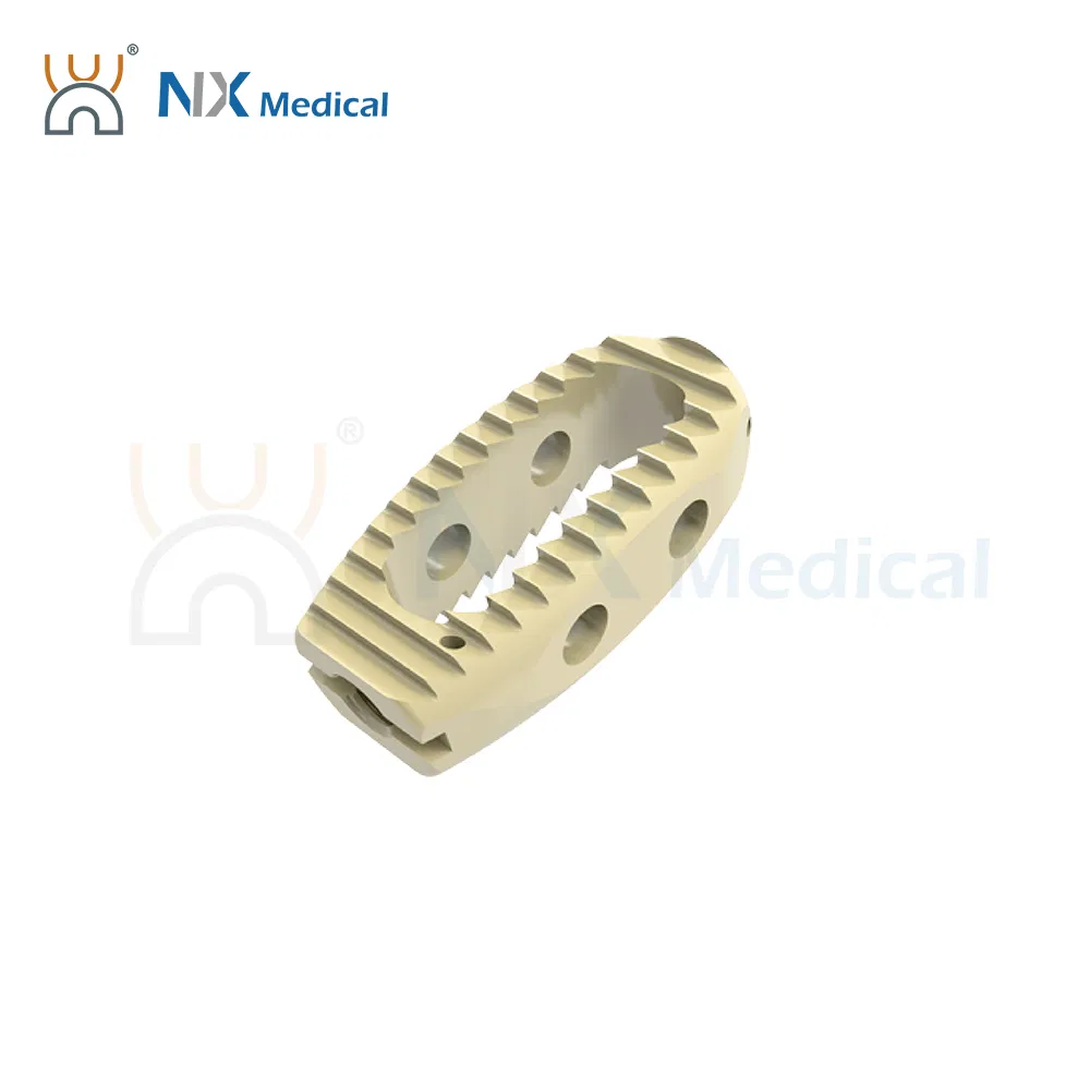 Nx Medical OEM/ODM Support Orthopedic Implant Lumbar Cage System for Bone Fixation