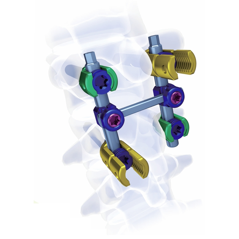 Titanium Pedicle Screw Spinal Lumbar Fixation System Medical Orthopaedic Surgery Implants Orthopedic Spine Surgical Instruments