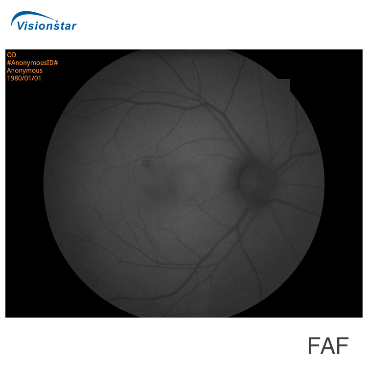 Aps-Cer (Model B) Fundus Camera &amp; Fluorescein Angiography System