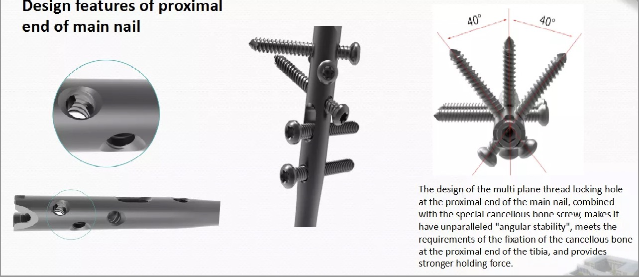 Tibia Intramedullary Nail System for Orthopedic Surgery