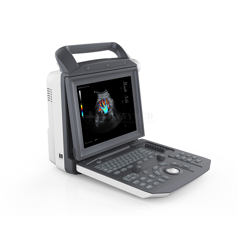 Sya-M5 3D 4D Color Doppler Laptop Cardiac Ultrasound System