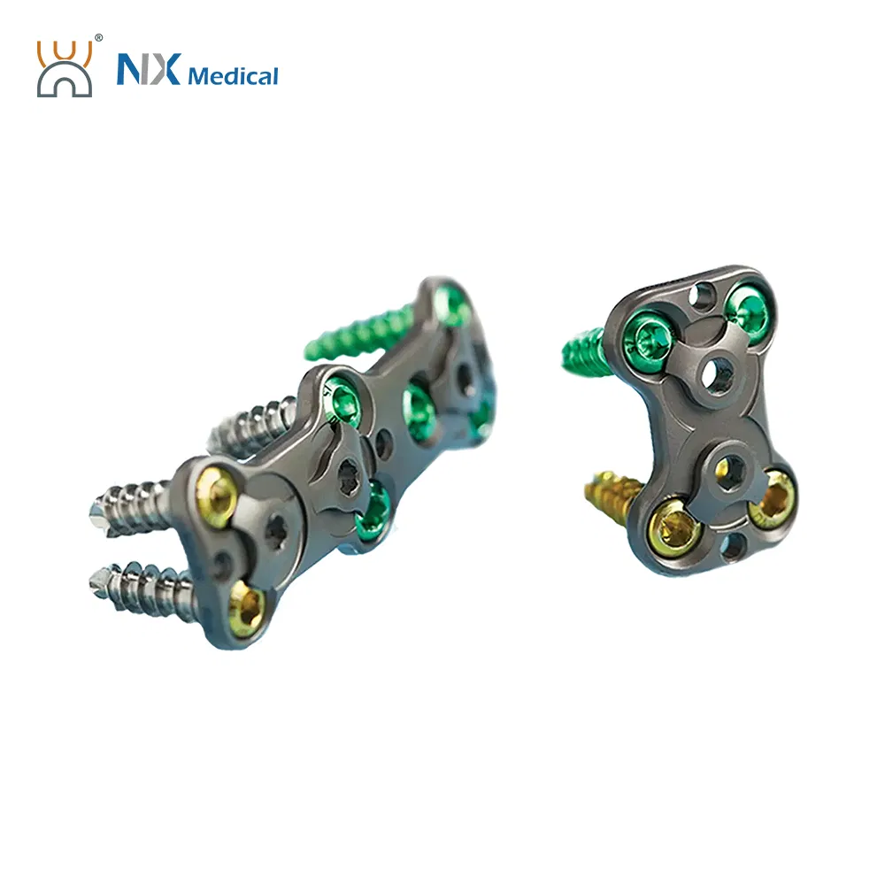 Nx Medical Anterior Cervical Plate System Spine Internal Fixation Titanium China Factory