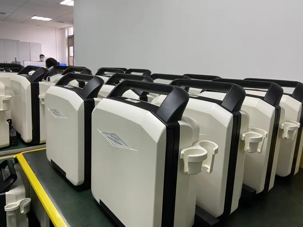 Ultrasound System View 2