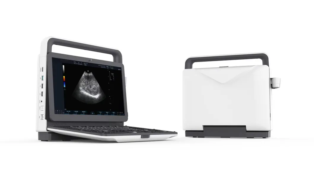 Color Doppler System