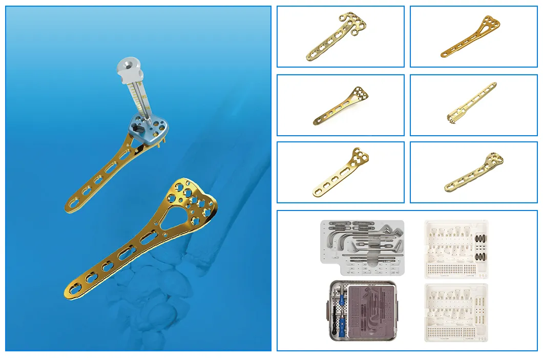 System Features Diagram