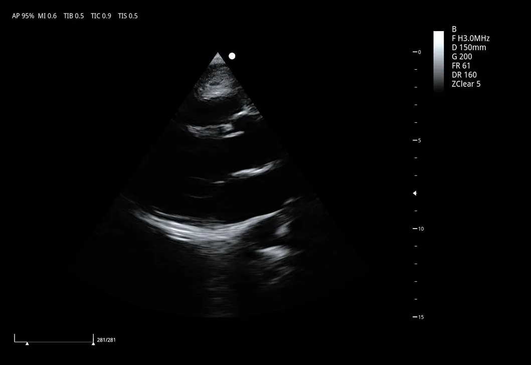 Ultrasound Detail 2