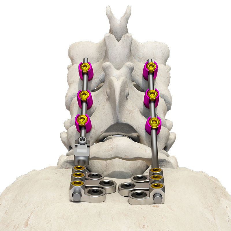 Low-Profile Posterior Occipital-Cervical-Thoracic Spinal System for Spinal Stabilization