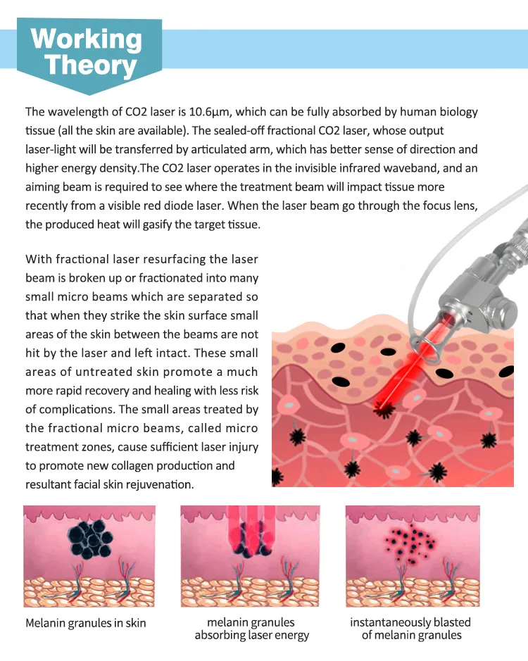 Working Theory Diagram