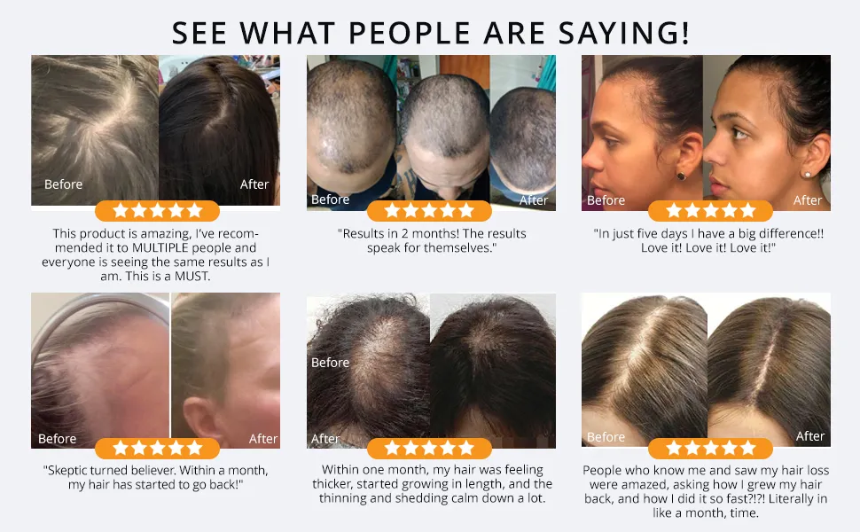 Hair Growth Oil Detail 6