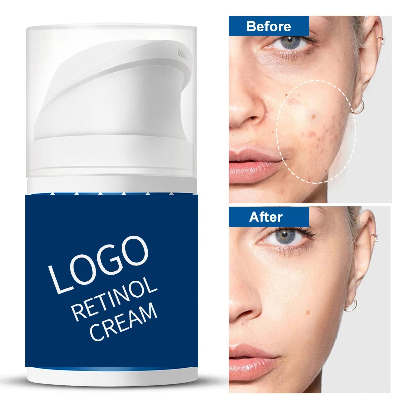 Ditong OEM ODM Retinol Moisturizing Repair Anti Wrinkle Face Cream