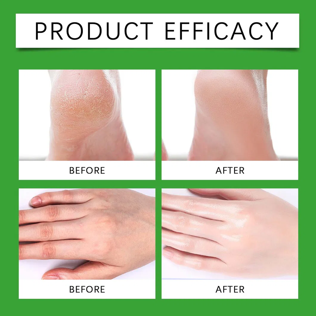 Foot Balm Stick Detail 5