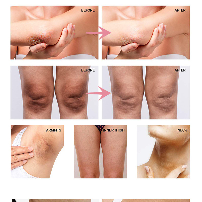 OEM Underarm Body Lotion with Ascorbic Acid Body Lotion for Skin Care, Exfoliation and Whitening Body Lotion