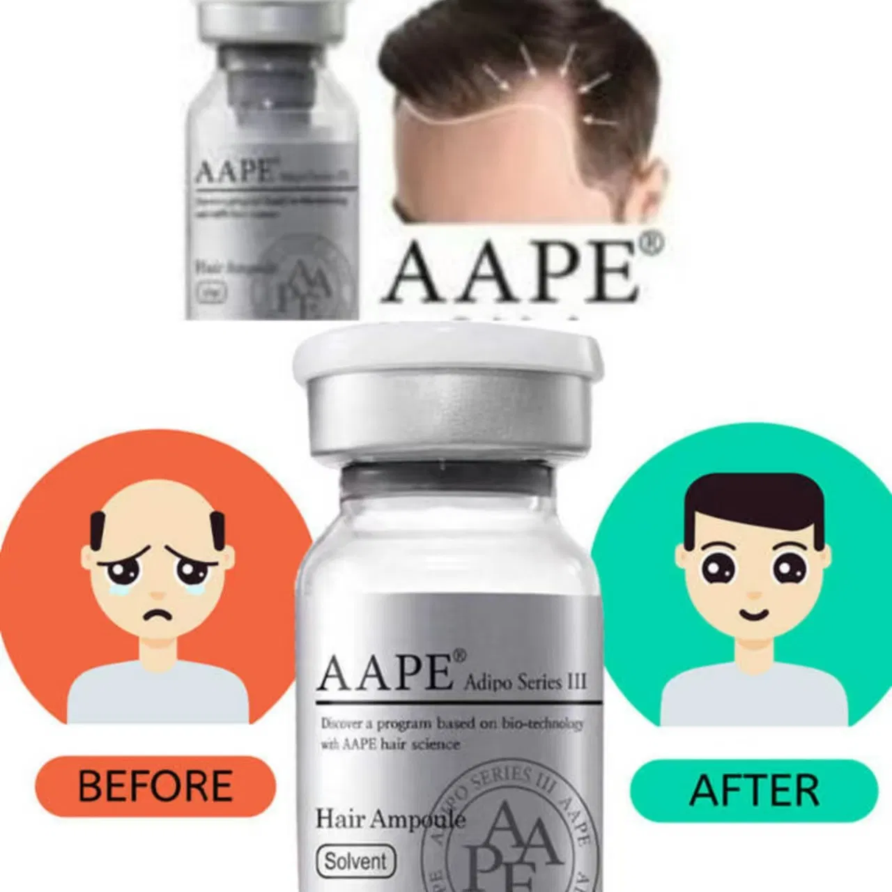 Korea Hair Growth Product Aape Hair Asce Hair Exosome 20mg Scm Haircare Booster Hair Loss Control Scalp Care Asce Hrlv