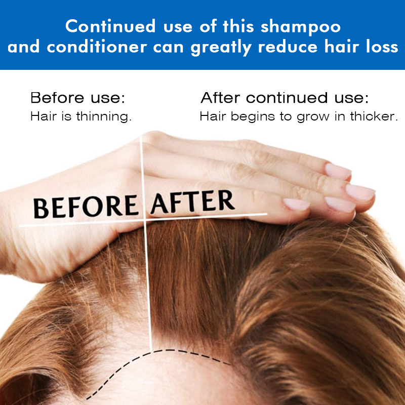 High Quality Blue Copper Peptide Shampoo and Conditioner for Hair Loss Anti-Loss Treatment Produces New Hair Growth