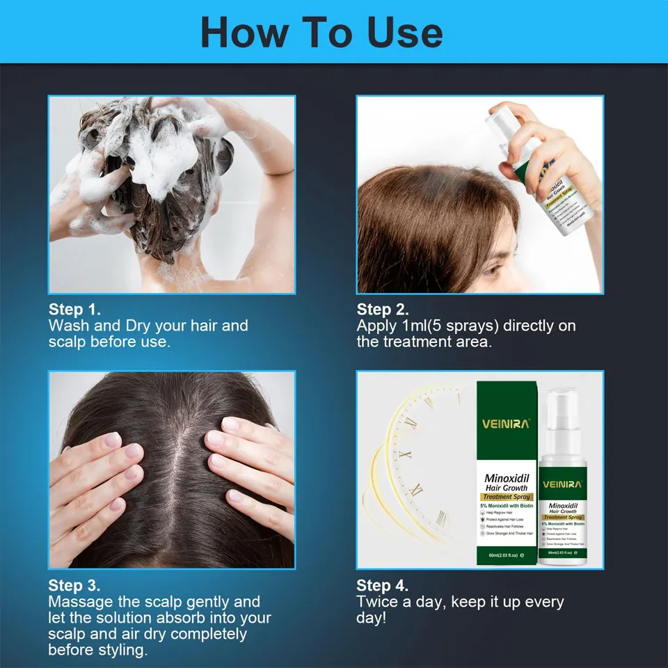 Minoxidil Treatment