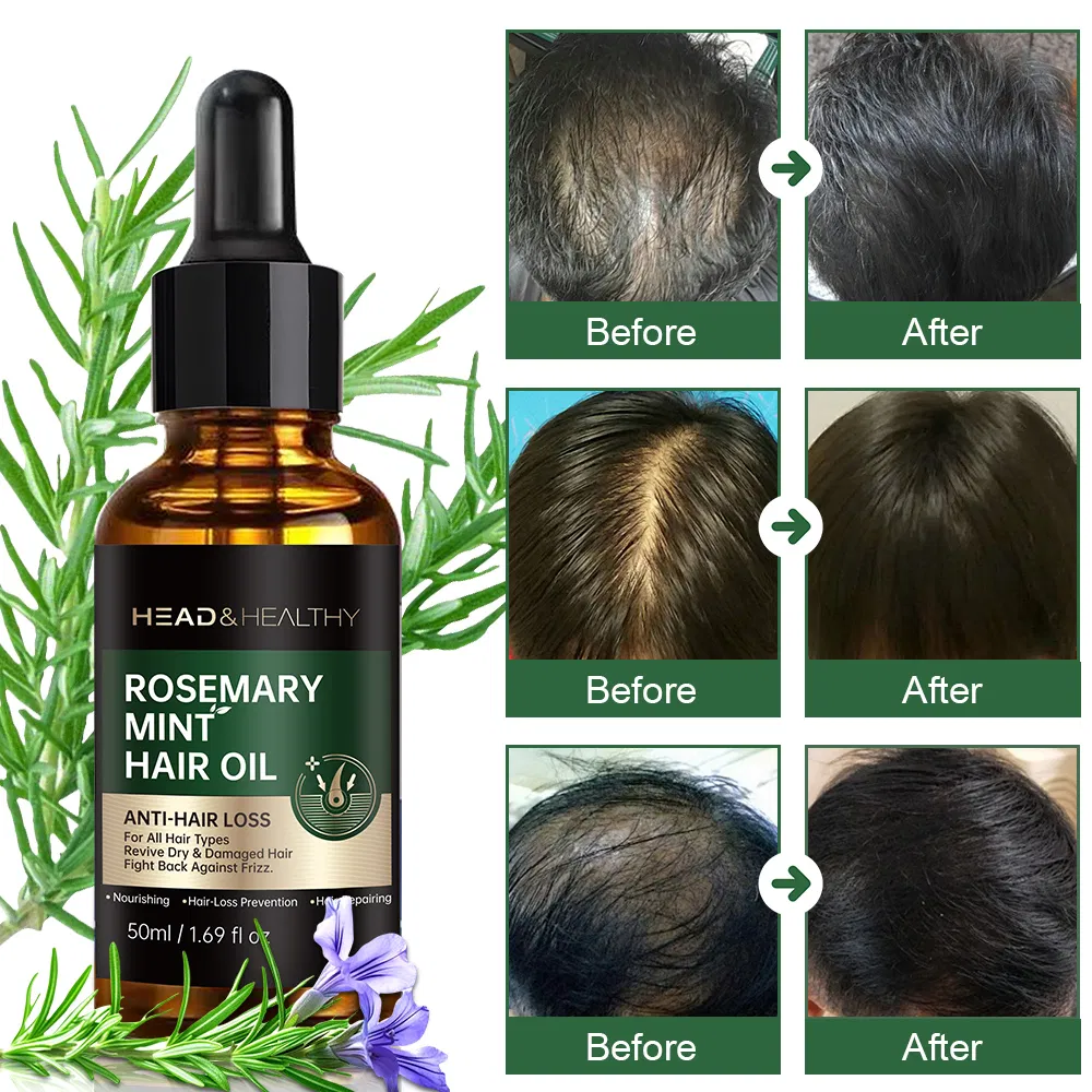 Rosemary Mint Scalp Oil 2