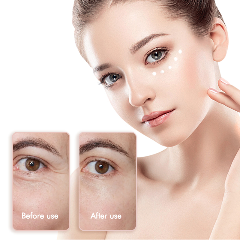 Herbal Flower Moisturizing Eye Treatment Rose Extract for Dark Circles Rose Eye Cream Puffiness Relief and Anti-Aging Benefits Soothing Hydration Eye Care