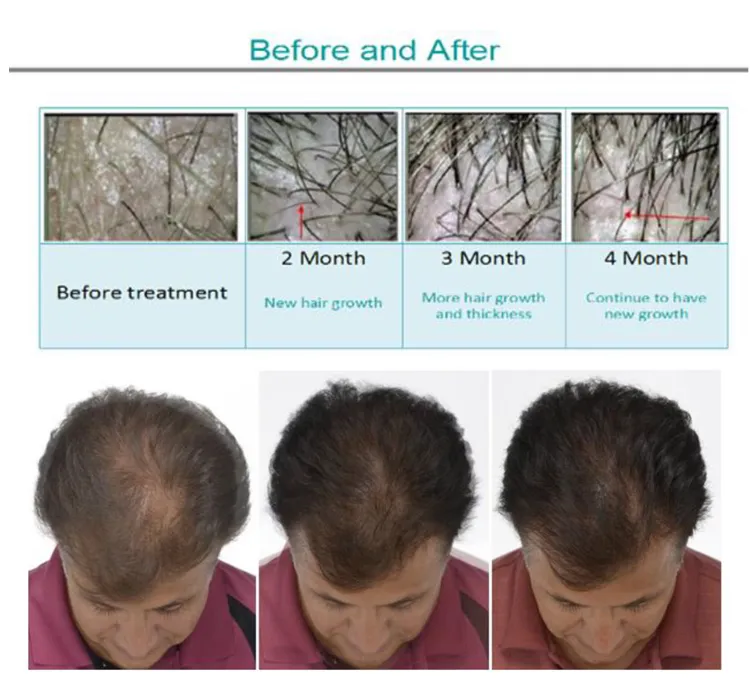 Scalp Care Machine 4