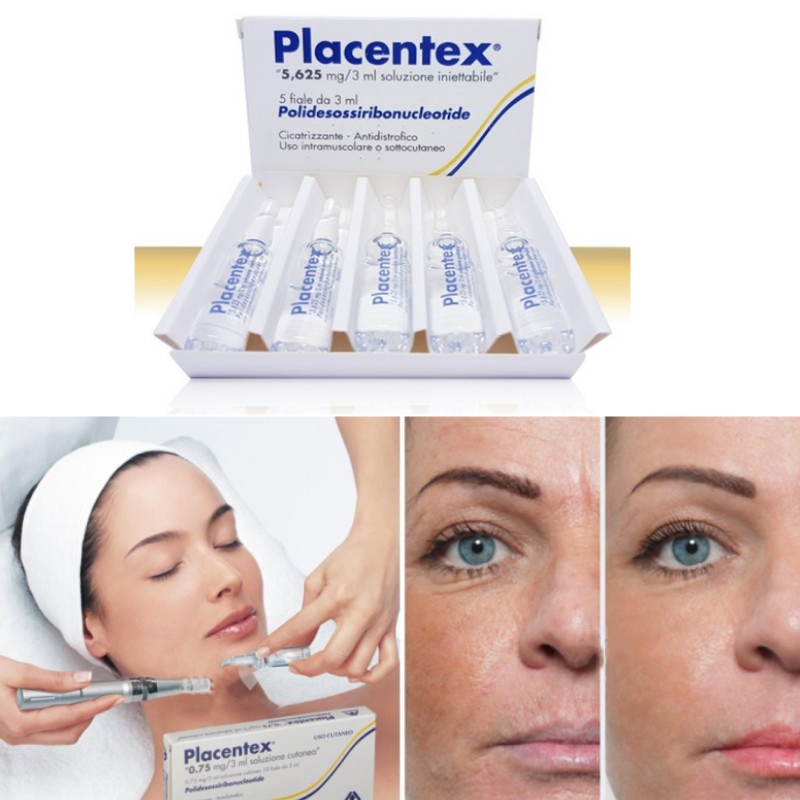 Scm Skin Booster Essence Human Stem Cell Skin Care Remove Acne Anti-Aging Placentex Pdrn