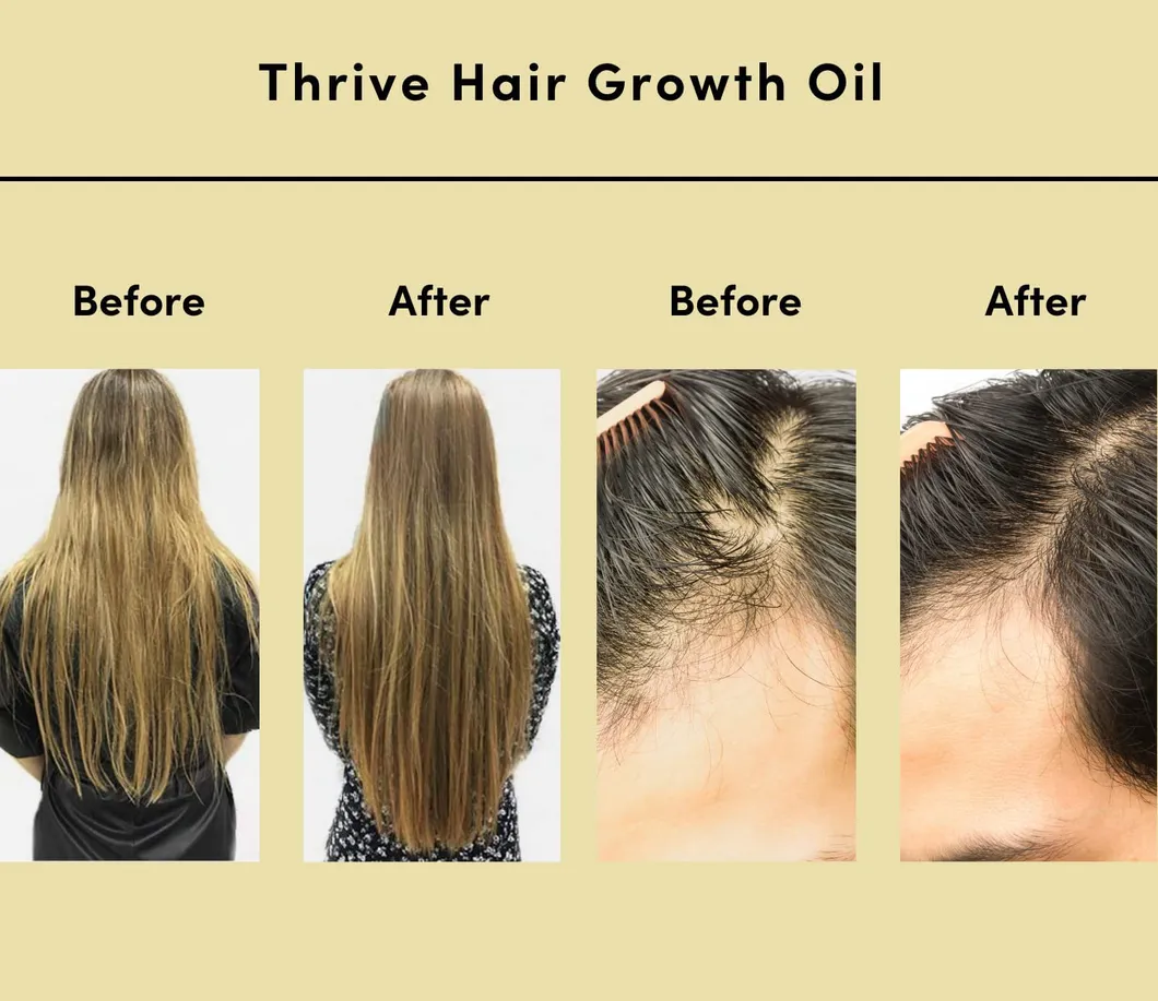 Hair Growth Oil Detail 5