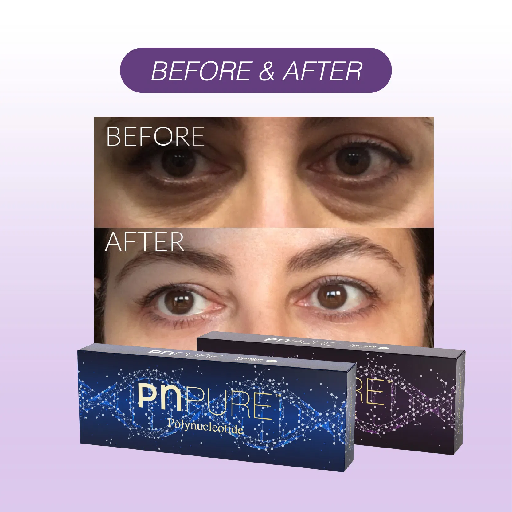 Wholesale Price Pn Booster Polynucleotide Eyes Care for Eye Area Skin Enhancer