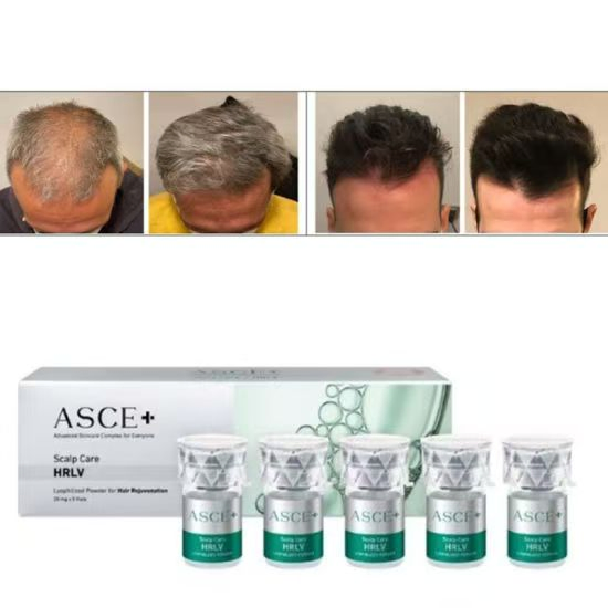 Korea Hair Growth Product Aape Hair Asce Hair Exosome 20mg Scm Haircare Booster Hair Loss Control Scalp Care Asce Hrlv