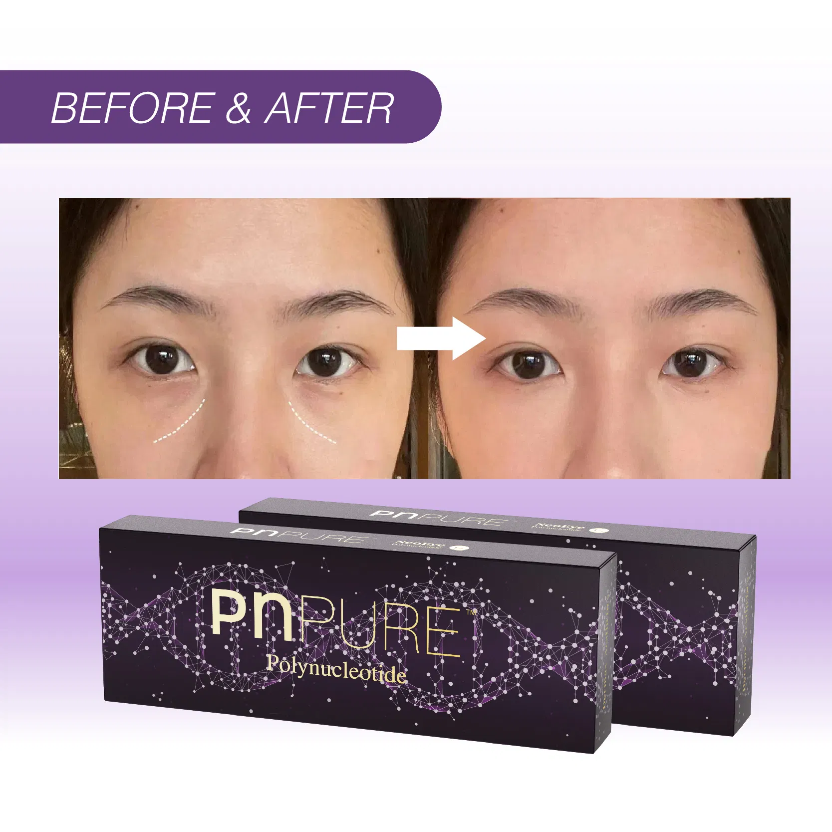 Wholesale Price Pn Booster Polynucleotide Eyes Care for Eye Area Skin Enhancer