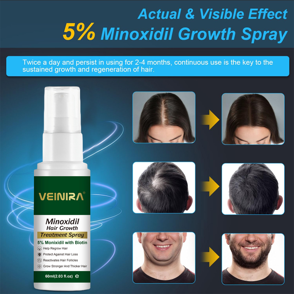 Minoxidil Hair Growth Anti Hair Lose Serum Thickening Treatment