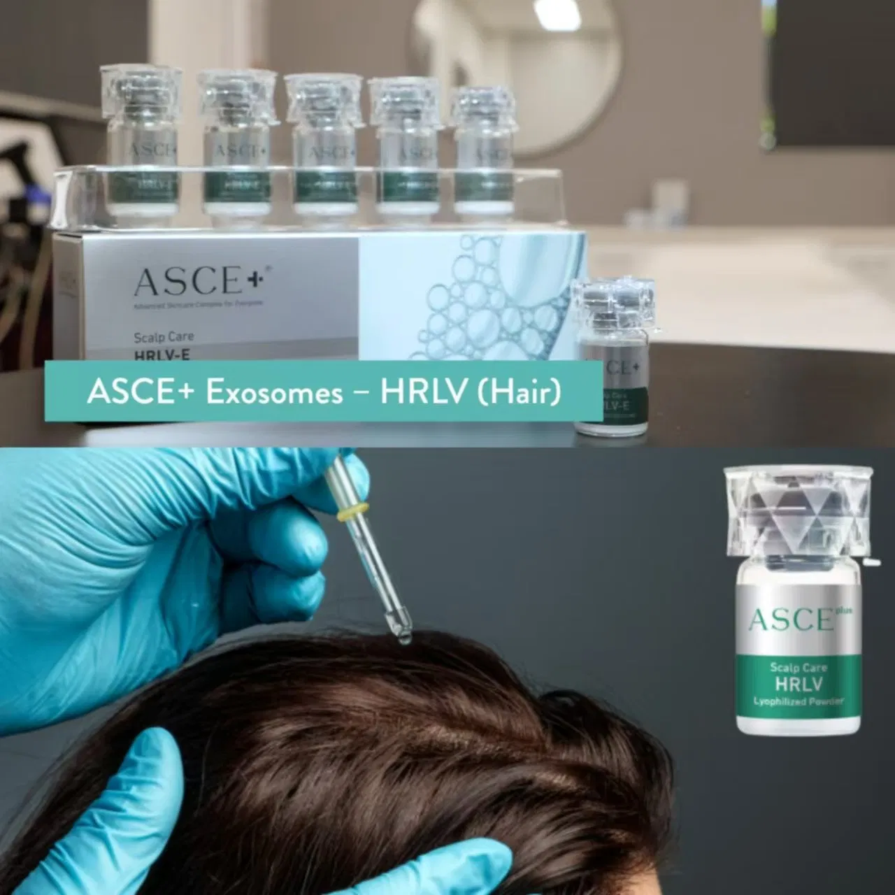 2025 Top Korean Exocobio Asce+ Hrlv Srlv Lyophilized Exosomes Micro Needling for Hair Restoration Scalp Care Anti Hair Loss Natural Way to Improve Hair Health