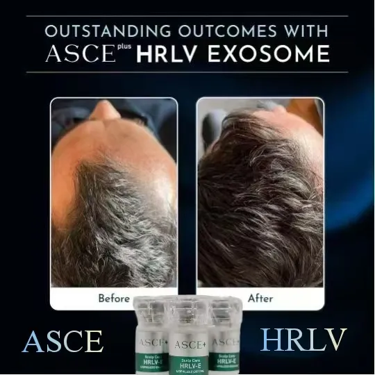 ASCE+ HRLV Banner