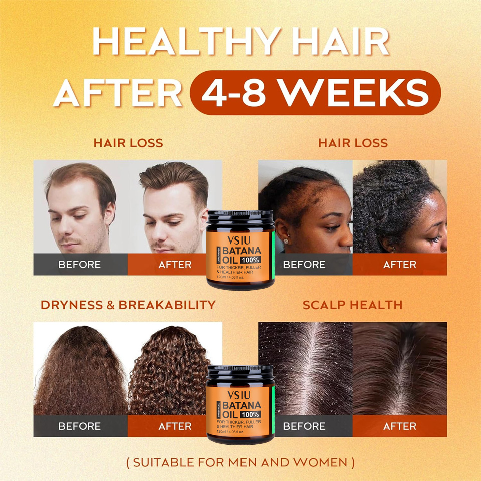 Raw Batana Oil for Hair Growth Pure Organic Batana for Thick and Strong Natural Hair