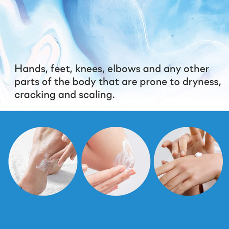 Custom Urea Cream for Moisturizes and Rehydrates Hand &amp; Foot Cream