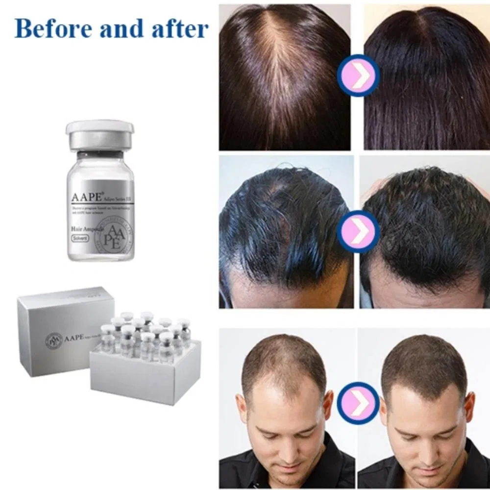 Scalp Problem Solution