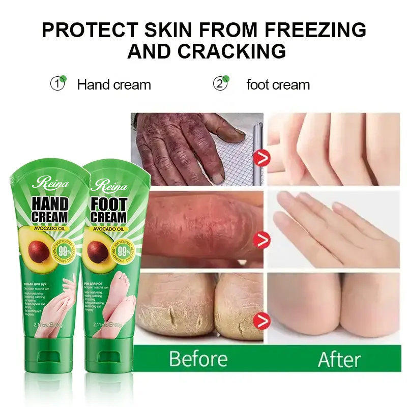Hot Sale OEM ODM Feet Repair Skin Moisturizing Hand Cream Horse Oil Foot Cream