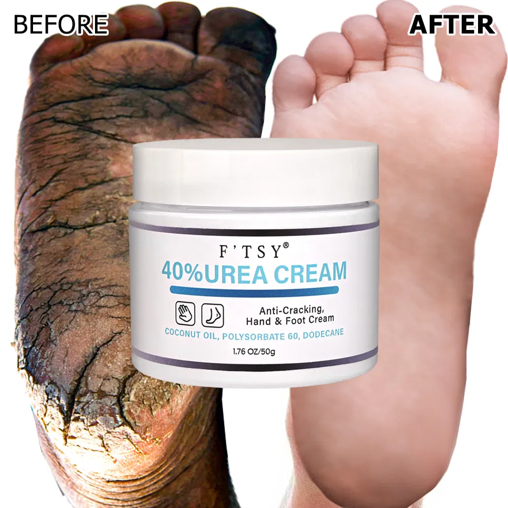 OEM Hot Selling Vegan Anti-Cracking Urea Cream Shea Butter Nourishing Hand Foot Cream