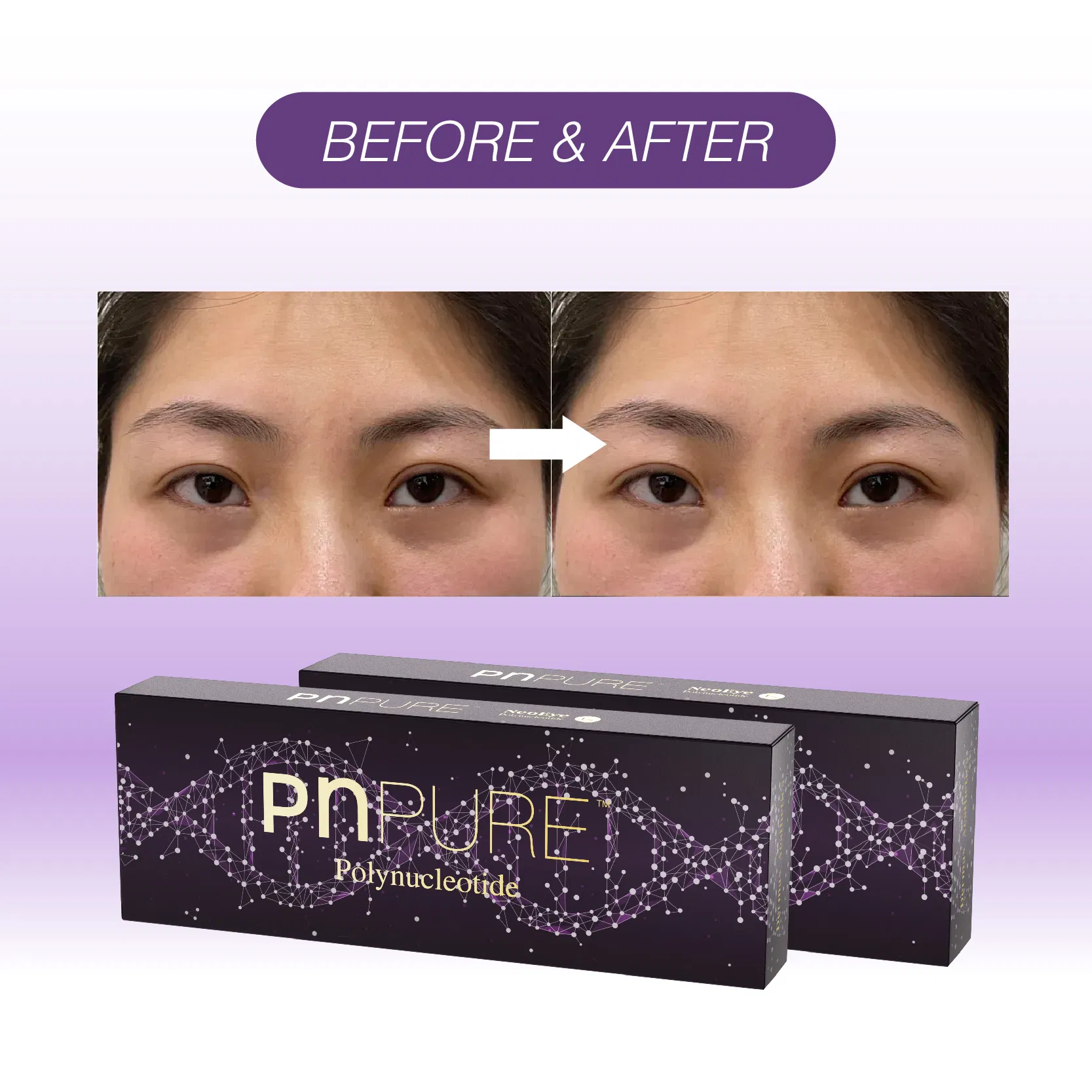 Wholesale Price Pn Booster Polynucleotide Eyes Care for Eye Area Skin Enhancer