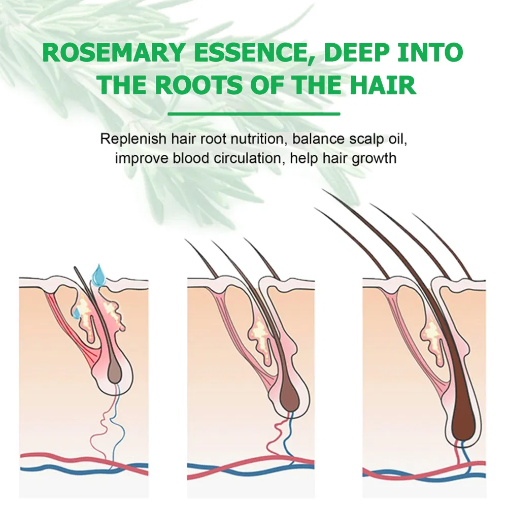OEM Organic Rosemary Castor Almond Scalp Care Serum Hair Treatment Growth Oil