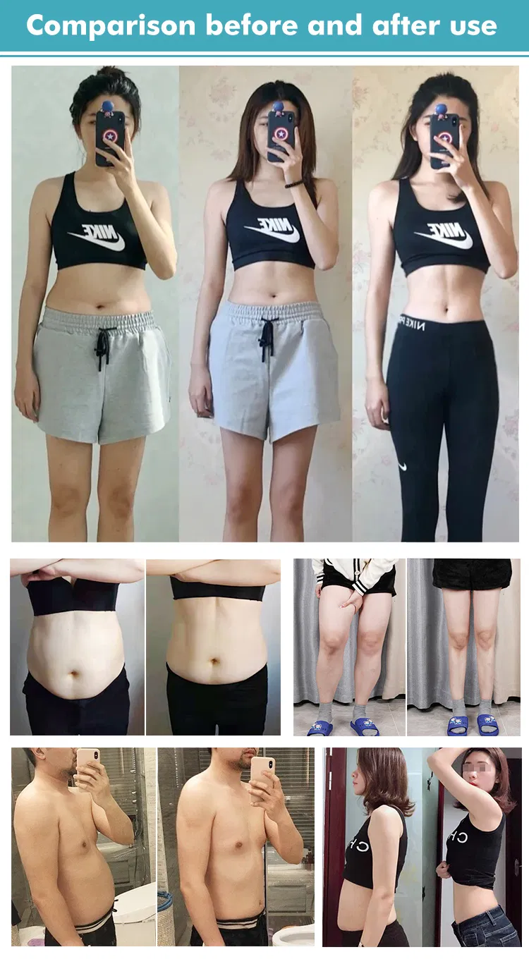 Traje desechable de presoterapia para todo el cuerpo con carro estético